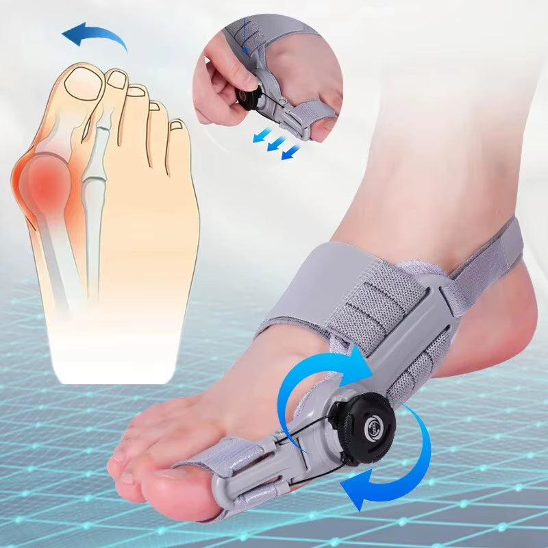 Bunion Be Gone! The Unisex Adjustable Hallux Valgus Brace with a Hip Rotatable Toe Separator for Happy Feet!