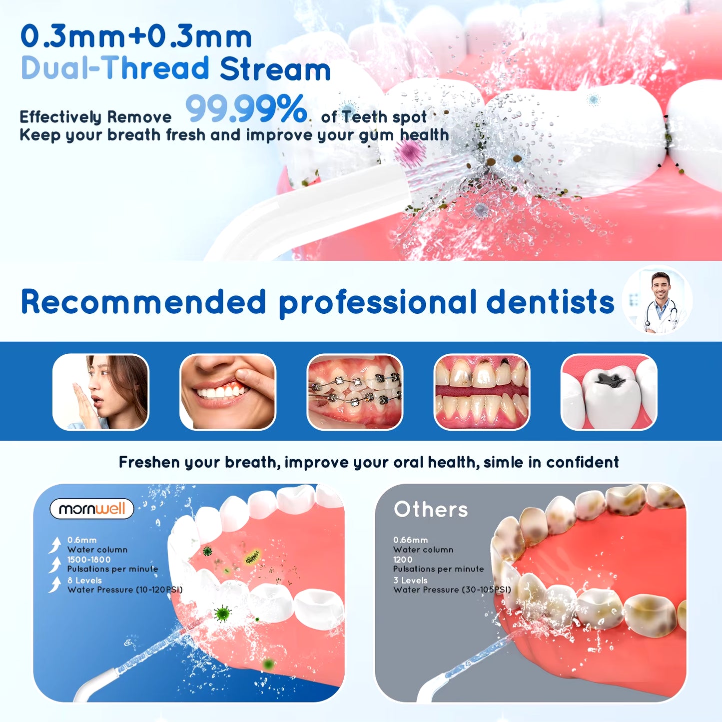 Portable USB Rechargeable Oral Irrigator D52 - 4 Jet Tips, 300ml, 3 Cleaning Modes for Ultimate Dental Care