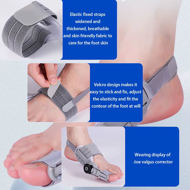 Bunion Be Gone! The Unisex Adjustable Hallux Valgus Brace with a Hip Rotatable Toe Separator for Happy Feet!