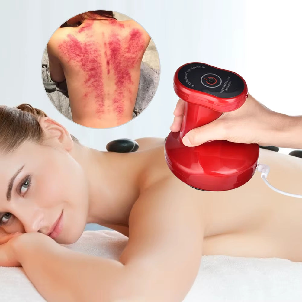 Revitalize Your Body with Electric Cupping Therapy - Dual Gear Vacuum Suction & Gua Sha Scraping Device for Meridian Healing and Fat Burning